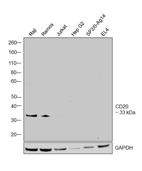 CD20 Antibody