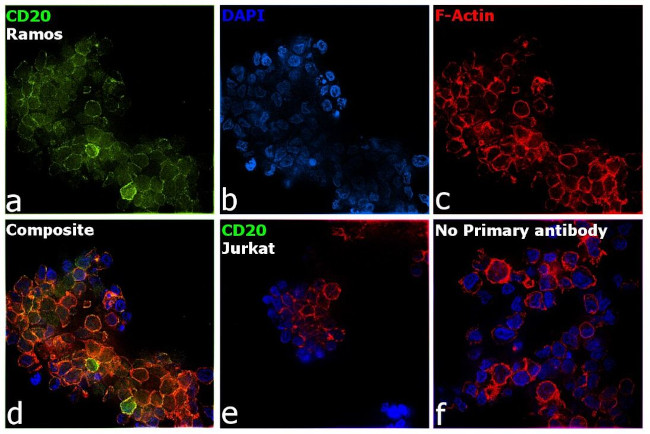 CD20 Antibody in Immunocytochemistry (ICC/IF)