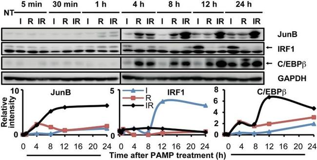 C/EBP beta Antibody in Western Blot (WB)