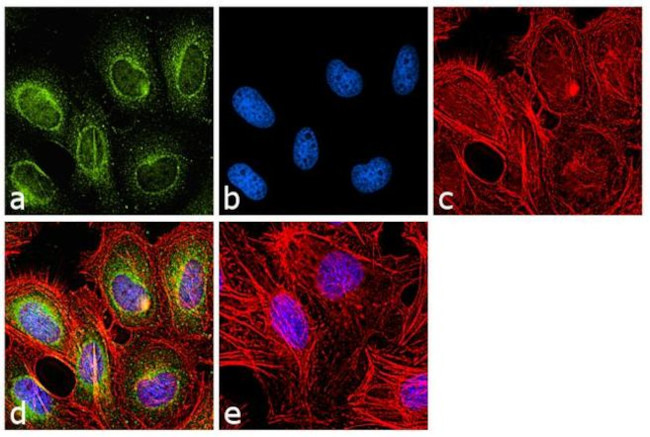 VRK1 Antibody in Immunocytochemistry (ICC/IF)