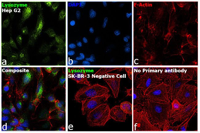 Lysozyme Antibody in Immunocytochemistry (ICC/IF)