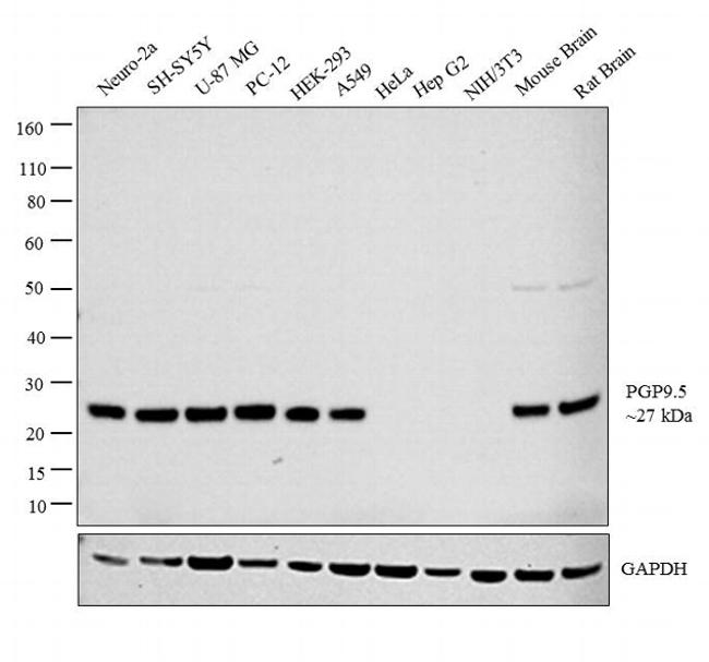 PGP9.5 Antibody in Western Blot (WB)