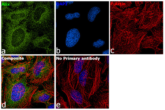 Alix Antibody in Immunocytochemistry (ICC/IF)