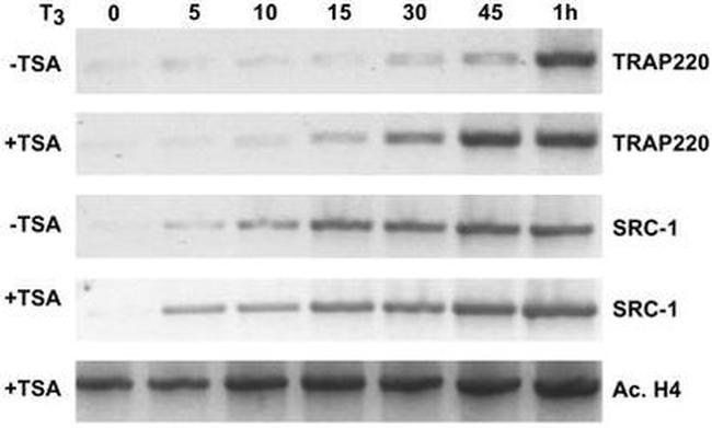 SRC1 Antibody in Western Blot (WB)