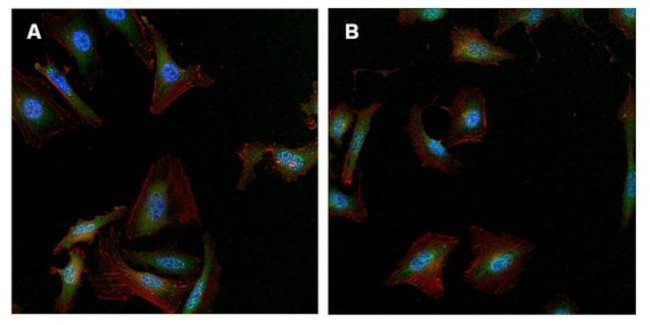 gamma Tubulin Antibody in Immunocytochemistry (ICC/IF)