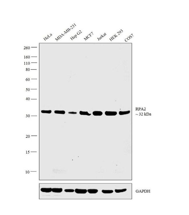 RPA2 Antibody in Western Blot (WB)