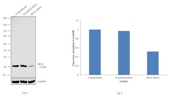 RPA2 Antibody in Western Blot (WB)