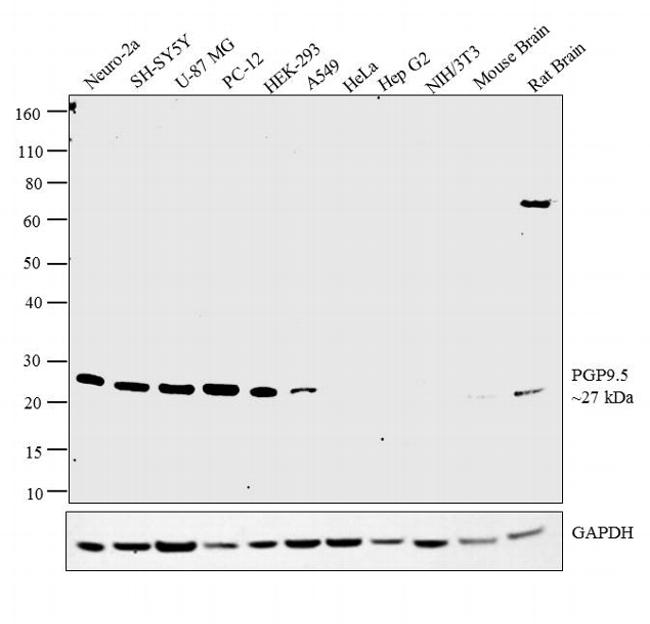 PGP9.5 Antibody in Western Blot (WB)