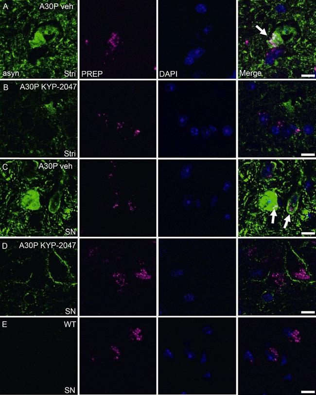 alpha Synuclein Antibody in Immunohistochemistry (IHC)