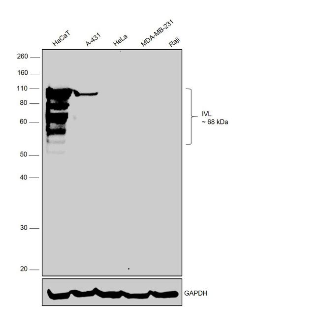 Involucrin Antibody in Western Blot (WB)