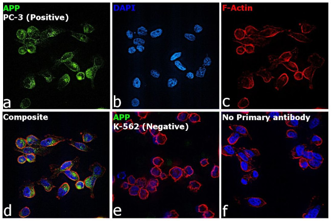 beta Amyloid Antibody