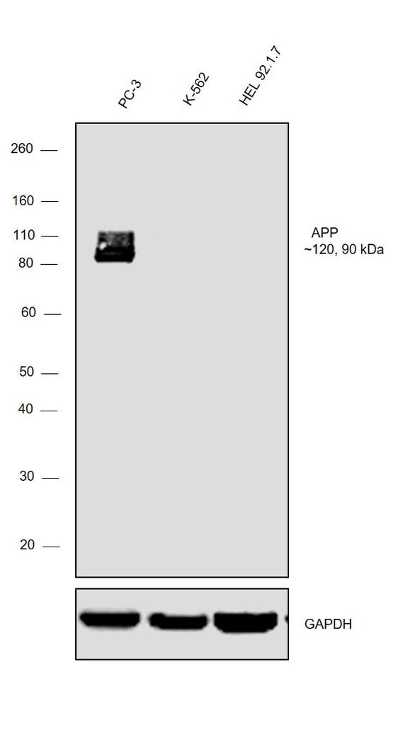 beta Amyloid Antibody