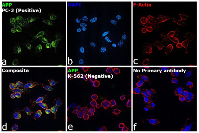 beta Amyloid Antibody in Immunocytochemistry (ICC/IF)