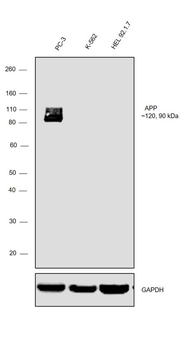 beta Amyloid Antibody in Western Blot (WB)