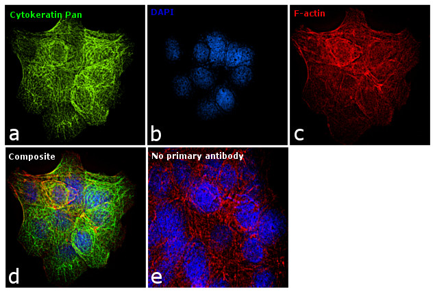 Cytokeratin Pan Antibody in Immunocytochemistry (ICC/IF)