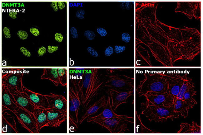 DNMT3A Antibody in Immunocytochemistry (ICC/IF)