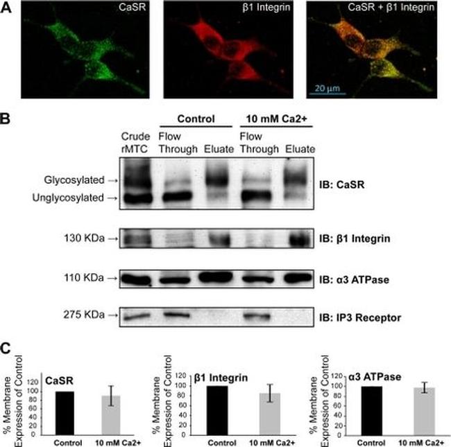 Calcium Sensing Receptor Antibody in Western Blot (WB)