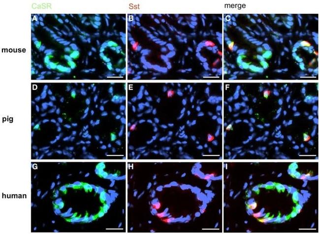 Calcium Sensing Receptor Antibody in Immunohistochemistry (IHC)