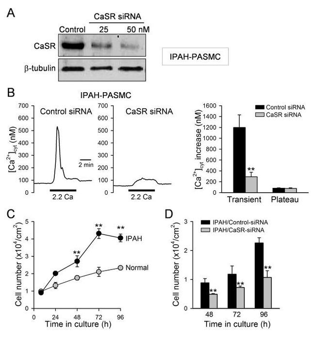 Calcium Sensing Receptor Antibody in Western Blot (WB)