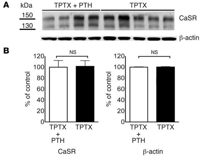 Calcium Sensing Receptor Antibody in Western Blot (WB)