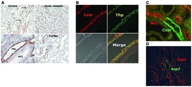 Calcium Sensing Receptor Antibody in Immunohistochemistry (IHC)