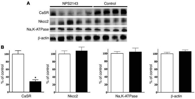 Calcium Sensing Receptor Antibody in Western Blot (WB)