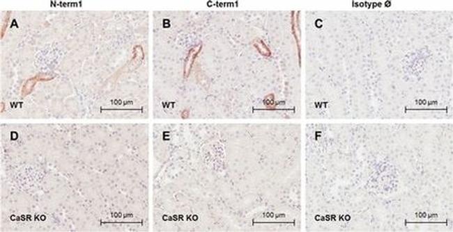 Calcium Sensing Receptor Antibody in Immunohistochemistry (IHC)