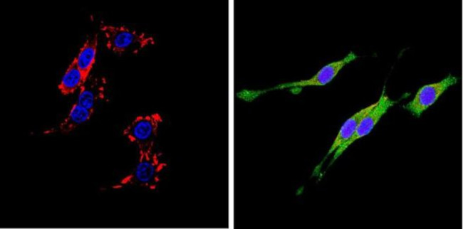 CD26 Antibody in Immunocytochemistry (ICC/IF)