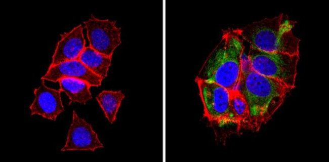 BAP31 Antibody in Immunocytochemistry (ICC/IF)