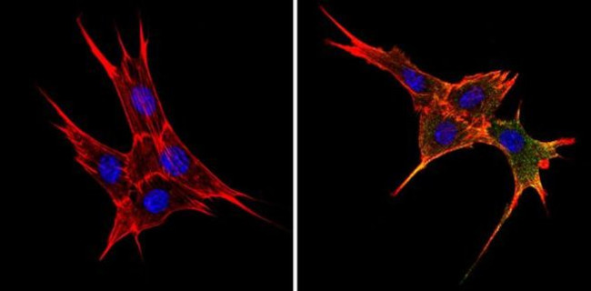 BAP31 Antibody in Immunocytochemistry (ICC/IF)