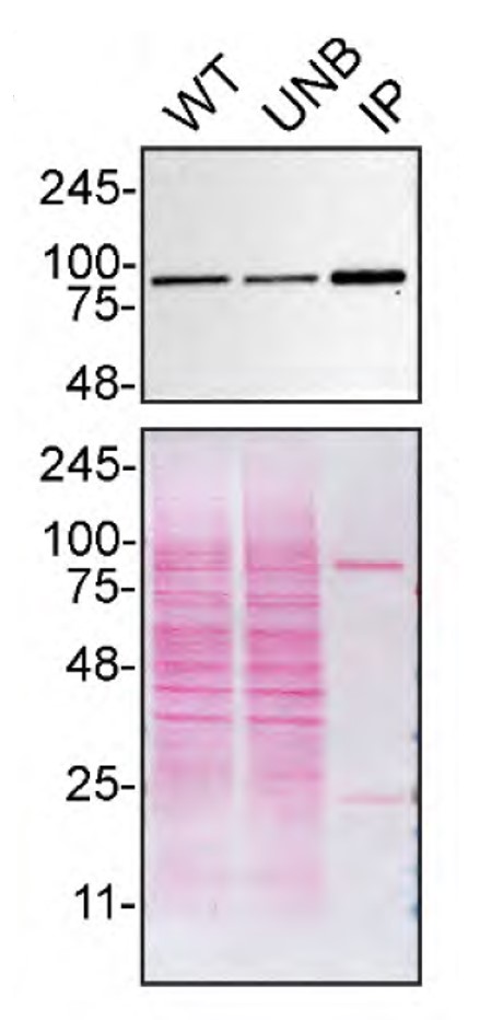 VCP Antibody in Immunoprecipitation (IP)