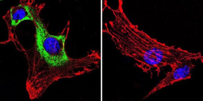 VCP Antibody in Immunocytochemistry (ICC/IF)