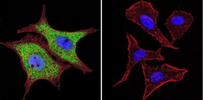 VCP Antibody in Immunocytochemistry (ICC/IF)