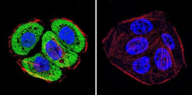 VCP Antibody in Immunocytochemistry (ICC/IF)