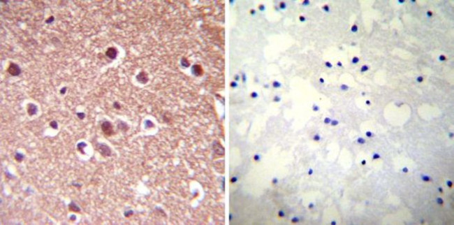 VCP Antibody in Immunohistochemistry (Paraffin) (IHC (P))