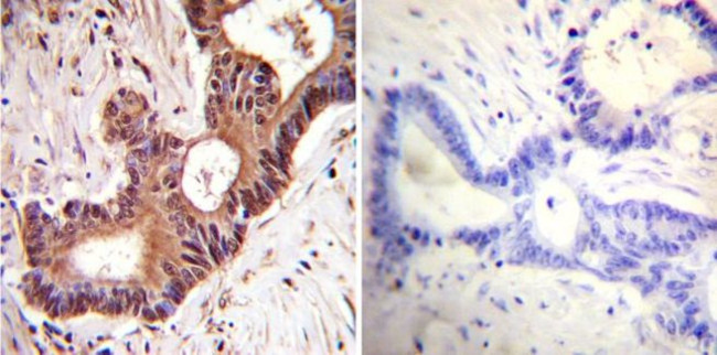 VCP Antibody in Immunohistochemistry (Paraffin) (IHC (P))