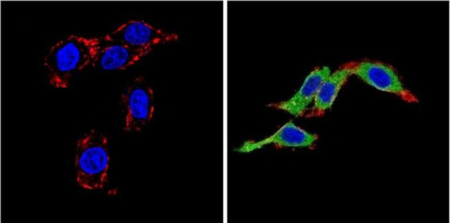 Endothelin 1 Antibody in Immunocytochemistry (ICC/IF)