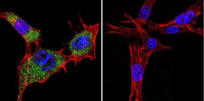 HSP70 Antibody in Immunocytochemistry (ICC/IF)