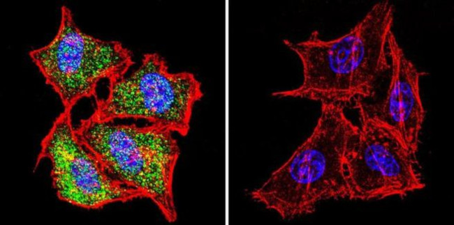 HSP70 Antibody in Immunocytochemistry (ICC/IF)