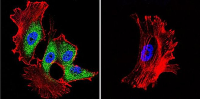 HSP70 Antibody in Immunocytochemistry (ICC/IF)