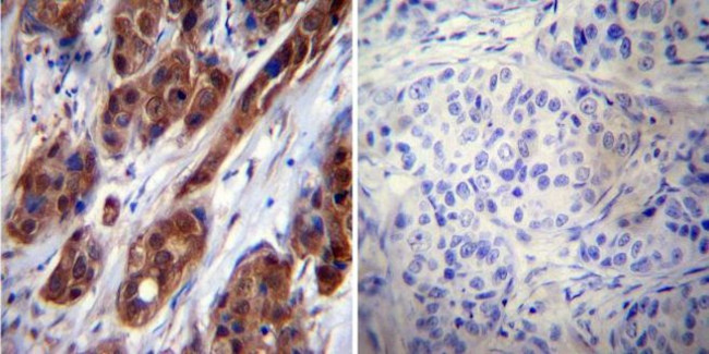 HSP70 Antibody in Immunohistochemistry (Paraffin) (IHC (P))