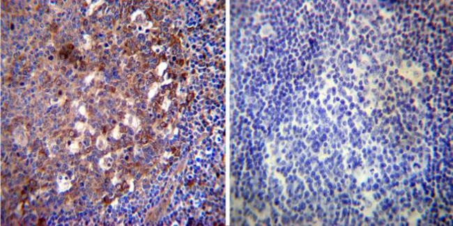 HSP70 Antibody in Immunohistochemistry (Paraffin) (IHC (P))