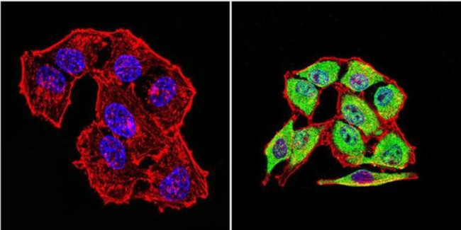 HSP70 Antibody in Immunocytochemistry (ICC/IF)