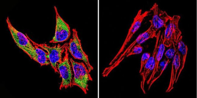 HSP70 Antibody in Immunocytochemistry (ICC/IF)