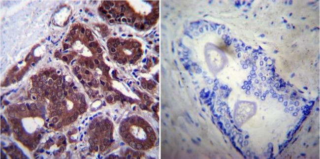 HSP70 Antibody in Immunohistochemistry (Paraffin) (IHC (P))