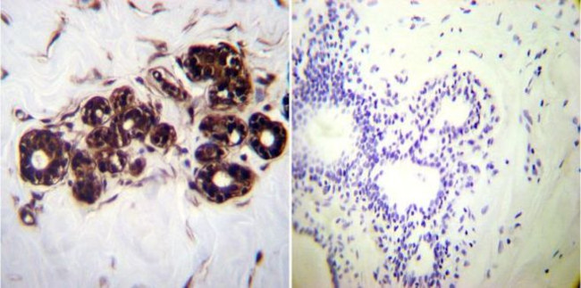 HSP70 Antibody in Immunohistochemistry (Paraffin) (IHC (P))