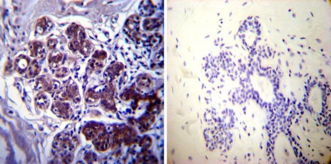 HSP70 Antibody in Immunohistochemistry (Paraffin) (IHC (P))