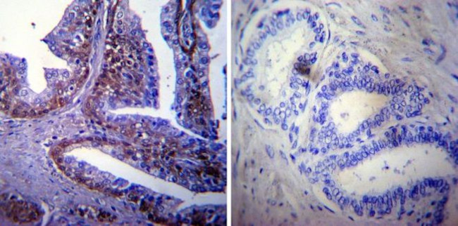 HSP70 Antibody in Immunohistochemistry (Paraffin) (IHC (P))