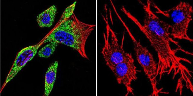 HSP90 alpha Antibody in Immunocytochemistry (ICC/IF)