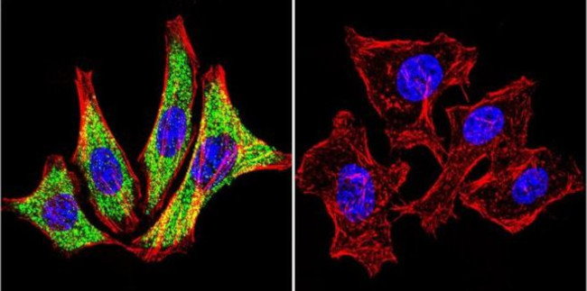 HSP90 alpha Antibody in Immunocytochemistry (ICC/IF)